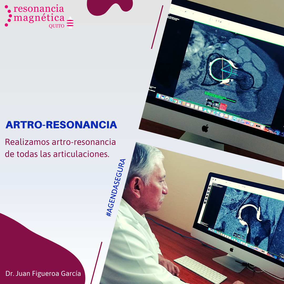 Download free bootstrap 4 admin dashboard, free boootstrap 4 templates