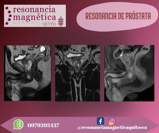 Download free bootstrap 4 admin dashboard, free boootstrap 4 templates