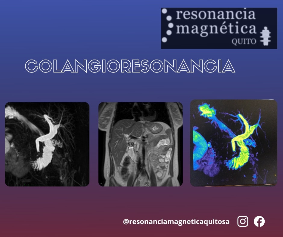 Download free bootstrap 4 admin dashboard, free boootstrap 4 templates