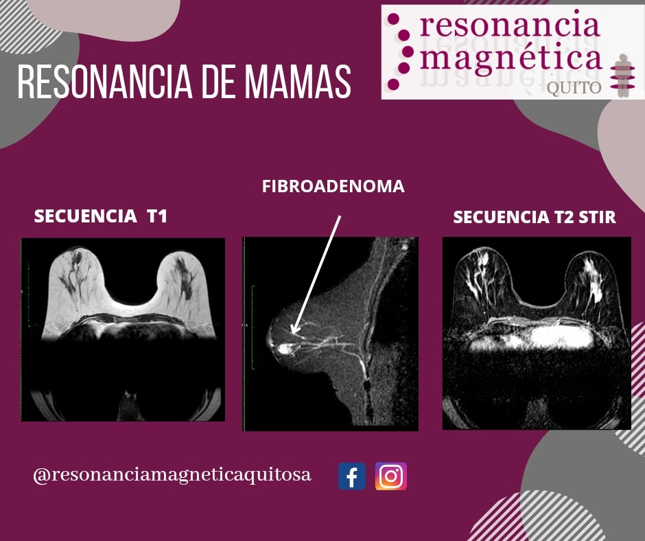 Download free bootstrap 4 admin dashboard, free boootstrap 4 templates