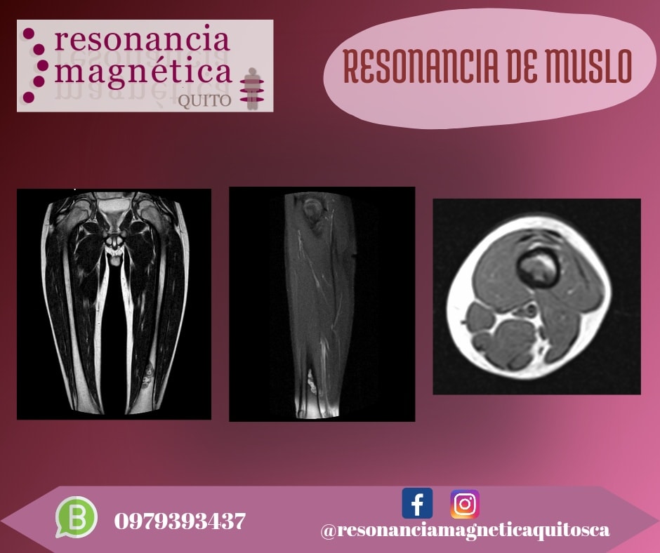 Download free bootstrap 4 admin dashboard, free boootstrap 4 templates