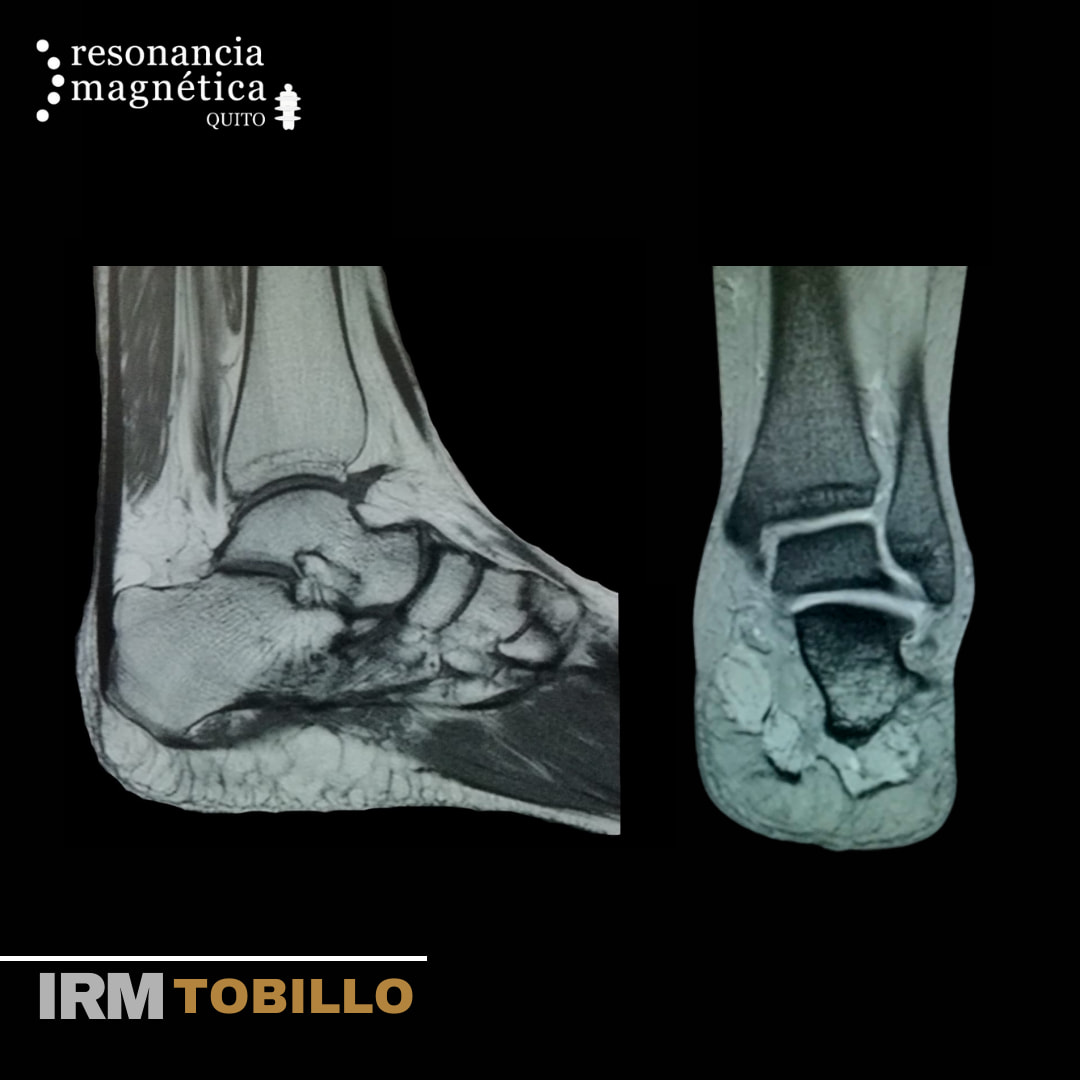 Download free bootstrap 4 admin dashboard, free boootstrap 4 templates