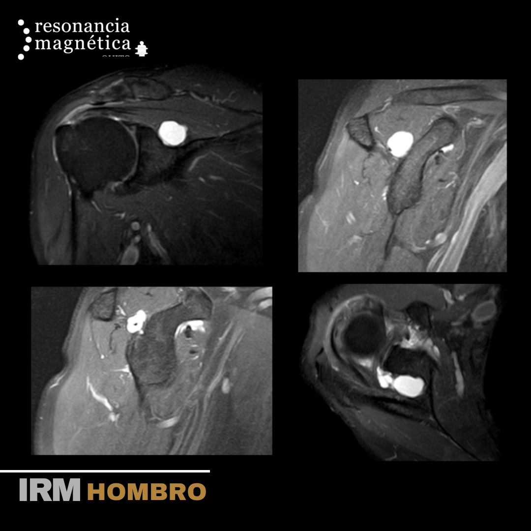 Download free bootstrap 4 admin dashboard, free boootstrap 4 templates