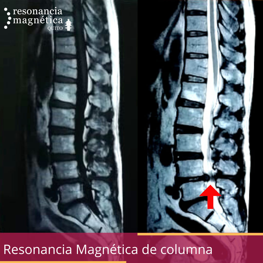 Download free bootstrap 4 admin dashboard, free boootstrap 4 templates