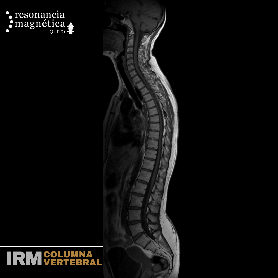 Download free bootstrap 4 admin dashboard, free boootstrap 4 templates