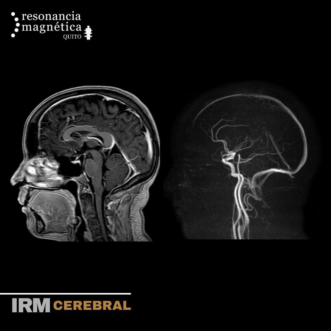 Download free bootstrap 4 admin dashboard, free boootstrap 4 templates