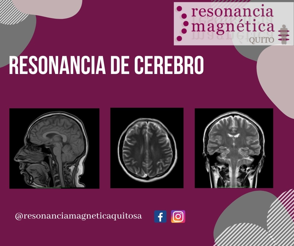 Download free bootstrap 4 admin dashboard, free boootstrap 4 templates